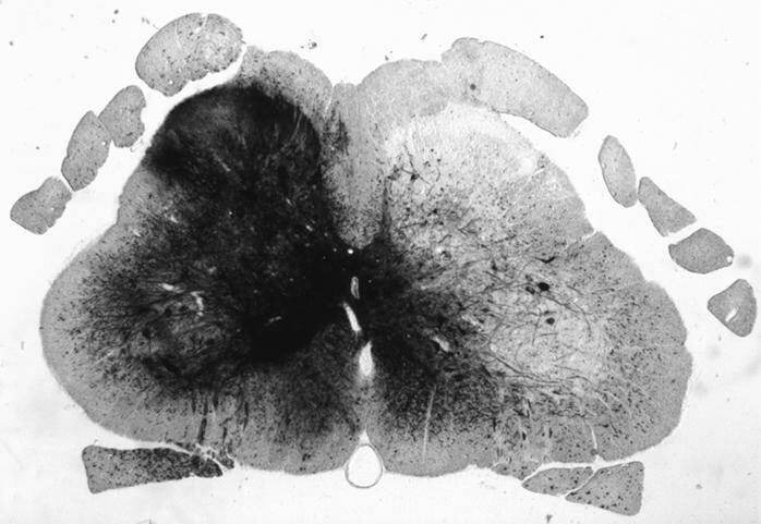 Figure A. Expression of beta-galactosidase using X-gal staining in adult rat spinal cord using VSV-G EIAV vector at 3 week post injection.