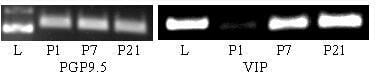 Fig. 1. Increase in VIP mRNA levels between P1-P21 (internal standard PGP9.5; L: Ladder).