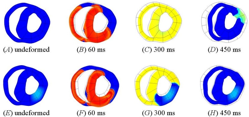 Figure 1. A tissue slice from the Auckland ventricular model (Smith et al. 2004) showing cell membrane potential and tissue deformation during normal electrical excitation (A)-(D) and with a region of acidosis in the left ventricular wall (E)-(H). The undeformed mesh is shown for reference.