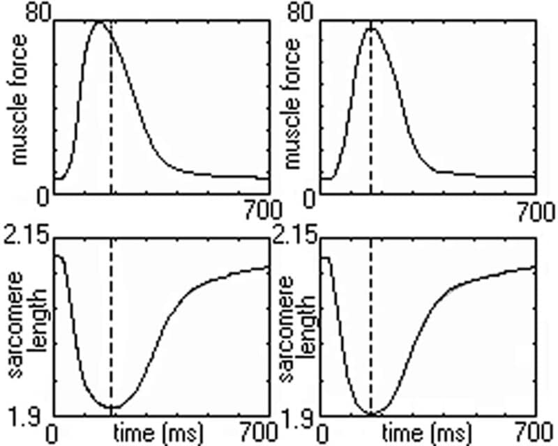 Simulation of the effect of viscosity on mismatch between the peak isometric force and sarcomere shortening. Left panels: in-series viscosity is switched on (VS2â‰ 0). Right panels: series viscosity is switched off (VS2=0). Muscle force (top panels) in mN sarcomere length (bottom panels) in micrometers