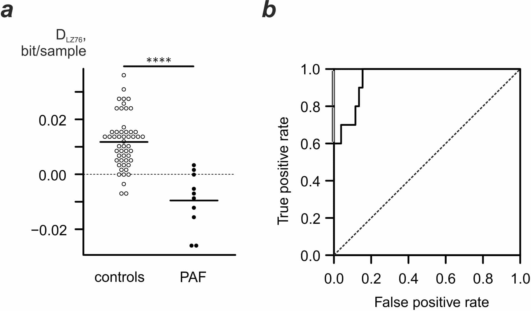 Fig.1. Heart rate adjusted complexity is indicative of PAF. a. combined complexity/heart rate metric values. b. Receiver operating curve for DLZ76 metric.