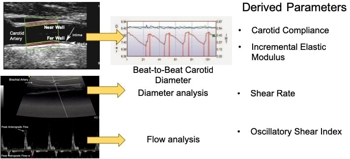 Figure 1. Representative Images of carotid and brachial artery for analysis