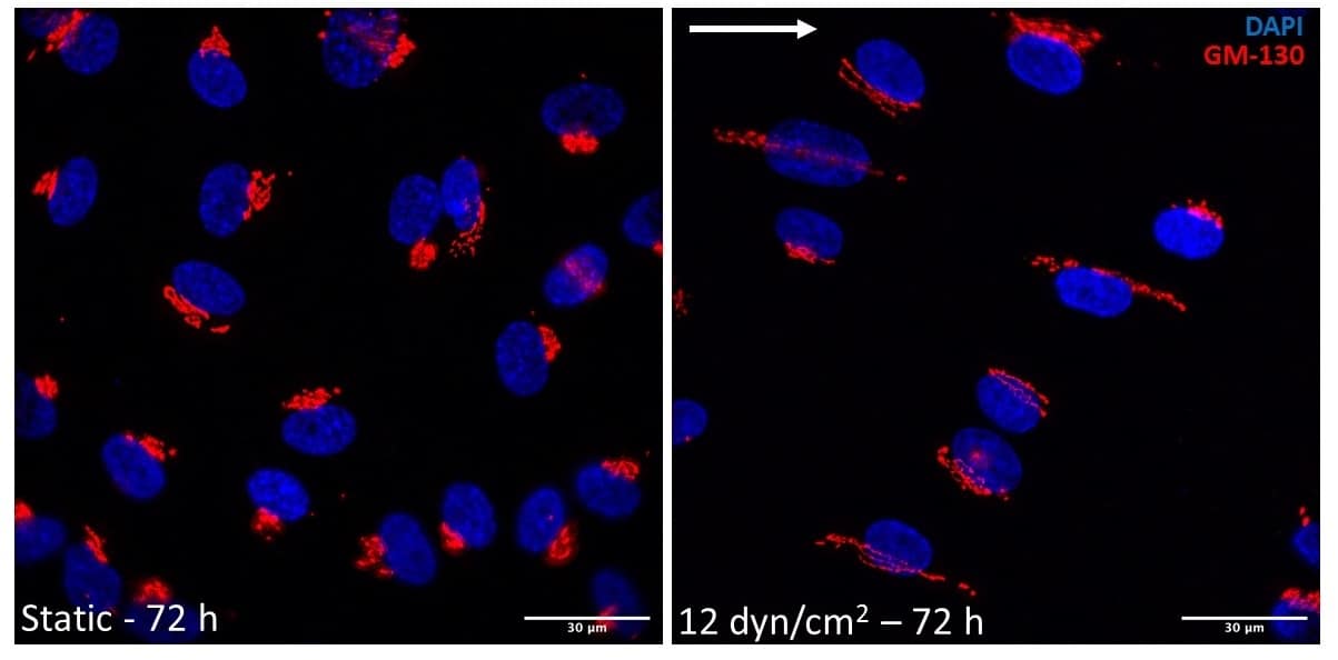 Figure 1 - Elongation and fragmentation of Golgi apparatus after exposure to high shear stress (right) for 72 hours (arrow indicates direction of flow), compared to static conditions (left).