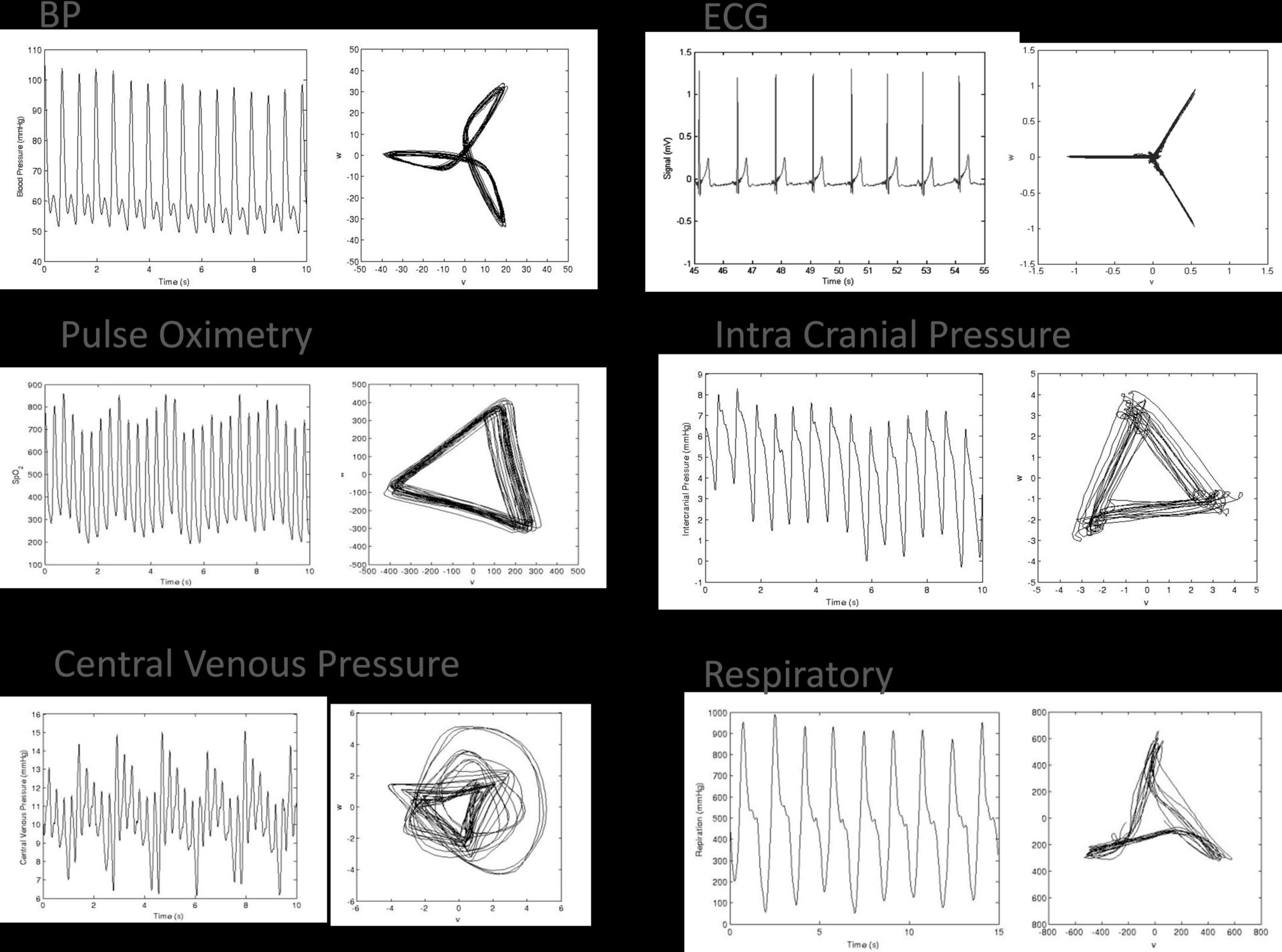 Attractor reconstruction analysis of 6 periodic physiological waveforms from humans: aBlood pressure (BP); bElectrocardiogram (ECG); aPulse Oximetry; aIntra Cranial Pressure; aCentral Venous Pressure and aRespiratory pressure. As the shape of input signal/waveform differs, so each generated attractor is unique and distinct. The attractor tracks through the data over time. Changes in the shape and dimensions of the attractor reflect perturbations in the upstroke and down stroke of the input waveform.Waveform data obtained from: a http//bsp.pdx.edu andb Physionet.