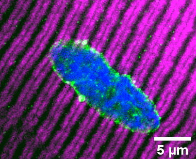 Myonucleus of an isolated skeletal muscle fibre extracted from a vastus lateralis biopsy of a young inactive individual. Myonuclei in these individuals, and in older hip fracture patients (model of disuse), are elongated, which contrasts rounder myonuclei in active younger and older counterparts. Fibres stained to visualise Myosin heavy chain 7 (magenta), nuclear envelope/LINC complex protein SUN1 (green) and DNA (blue).