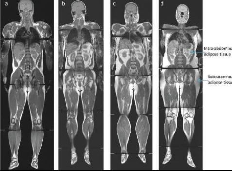 Body Fat Our Own Janus The Physiological Society Body Fat Our Own Janus The Physiological Society