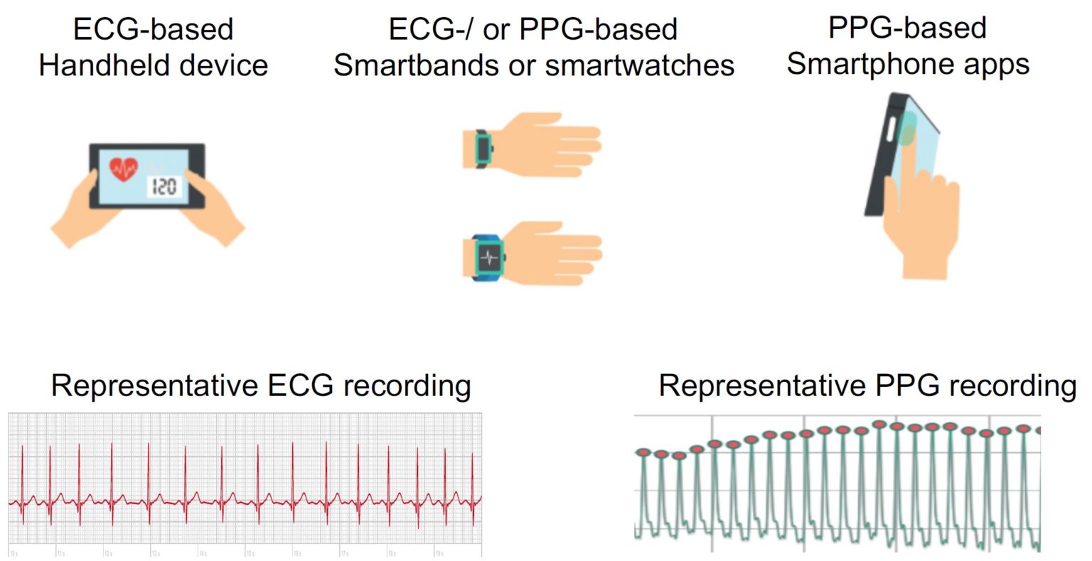 Remote heart rhythm assessment by a smartphone camera The Physiological Society