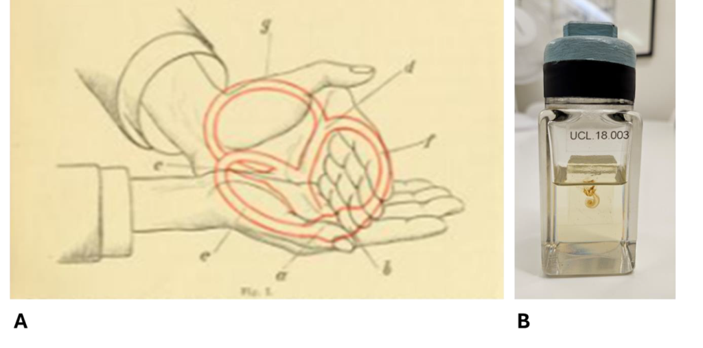 How does the Bárány Soundbox work? Find out more about this 1900 clockwork hearing test from the UCL History of Science Collection.