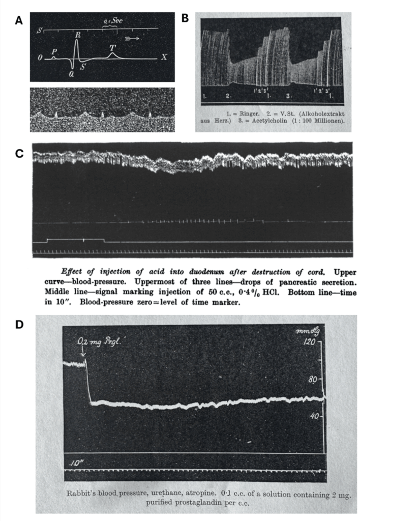 Society member Alireza Mani and the team from the UCL Historic Objects and Collections blog series return. Presenting Physiological Instrument #045, a kymograph. Discover the physiological data recorded by a rotating brass drum and smoked paper. 