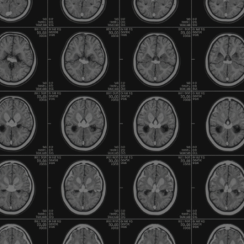Medical student Ahmed Abdelkarim Romana reflects on his internship at a top neuroscience department and shares his hopes for science research skills he'll share back home in Palestine.