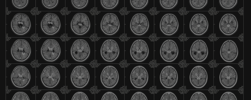 Medical student Ahmed Abdelkarim Romana reflects on his internship at a top neuroscience department and shares his hopes for science research skills he'll share back home in Palestine.