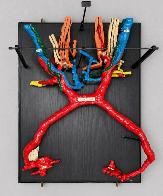 From squid giant axons to recording action potentials inside a nerve fibre. Discover how scientists solved the mystery of nerve transmission. 